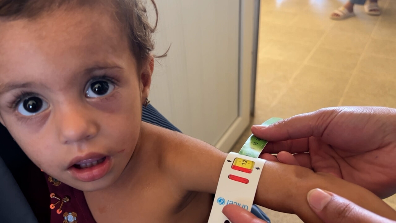 Afghanistan nutrition crisis – WFP